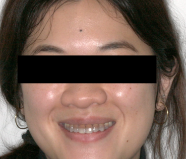 Figure 1. Preoperative 1:10 image of full face.