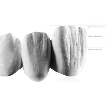 IPS emax ZirCAP Prime Gradient Technology